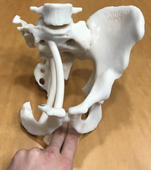 Model of a hip